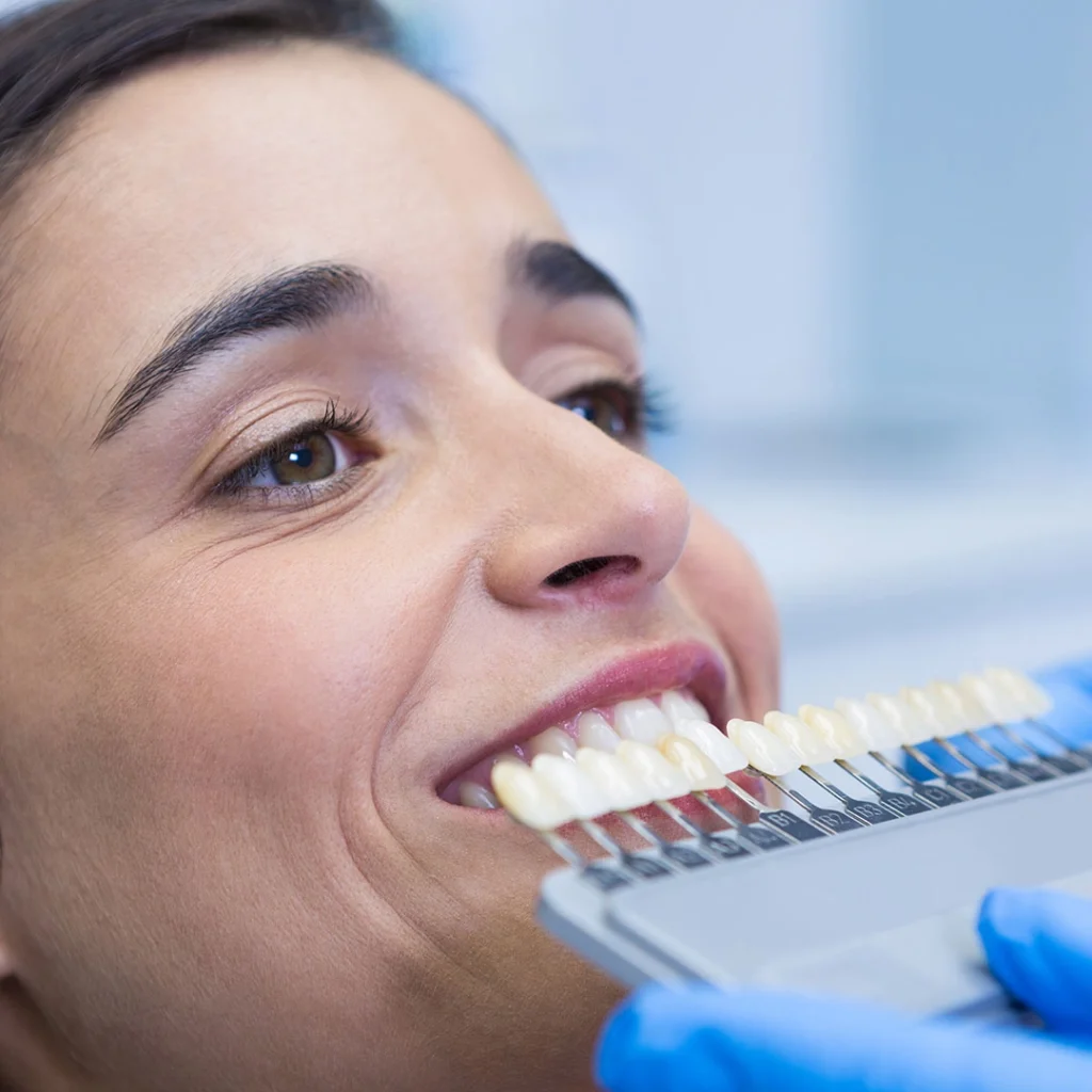 A dental professional comparing tooth shade samples using a shade guide in a clinical setting.
